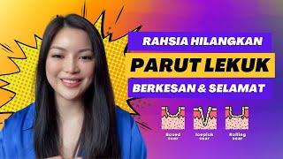 Beauty Tips  Rahsia hilangkan parut lekuk dengan BERKESAN dan SELAMAT