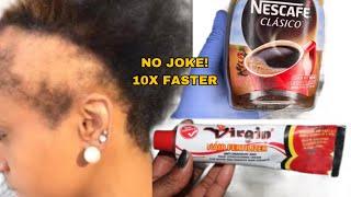 THIS HAIR GROWTH RECIPE WILL CHANGE LIVESHOW I USE COFFEE n VIRGIN HAIR FERTILIZER for hair growth