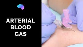 How to take an arterial blood gas ABG - OSCE guide  UKMLA  CPSA