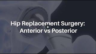 Hip Replacement Surgery Anterior vs Posterior  Lyfboat