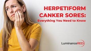 Herpetiform Canker Sores Everything You Need to Know