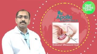 Anal Fistula Symptoms & Treatment- Apollo Health City