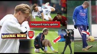 NEWS UPDATE After suffering Ankle Injury of Odegaard the Club officials release.....