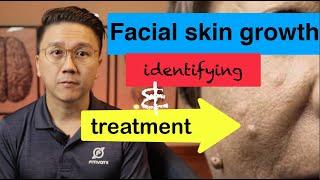 Growths on YOUR Face - Identifying and Treatment Part 12