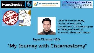 Iype Cherian MD My Journey with Cisternostomy