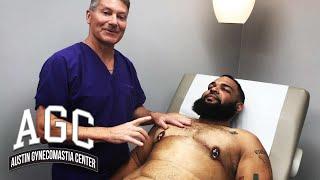 Massive Skin Excision Gynecomastia Removal with Nipple Graft - Recovery Update