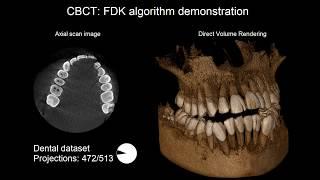 FDK algorithm demonstration