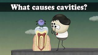 What causes cavities?  #aumsum #kids #science #education #children