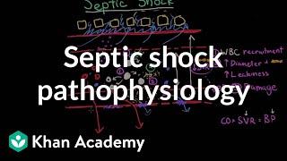 Septic shock - pathophysiology and symptoms  NCLEX-RN  Khan Academy