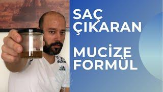 Saçlarım Yeniden Çıktı l Saç Çıkaran Mucize Doğal Kür l Saç Dökülmesine Karşı Çözüm