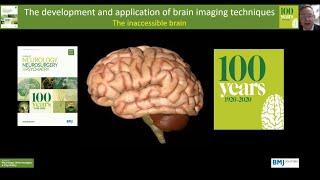 Brain Imaging The development and application of imaging techniques