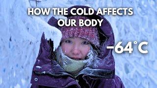 How Living in the World’s Coldest City Affects Our Body −64°C −84°F? Yakutsk Siberia