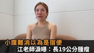 小腹難消以為是宿便　江老師淚曝：長19公分腫瘤