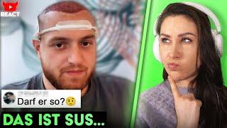 Sollen Influencer ein Werbeverbot für Schönheits- OPs bekommen? ‪Haartransplantation und vieles mehr