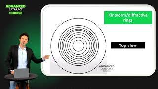 Basic Principles of Multifocal IOLs