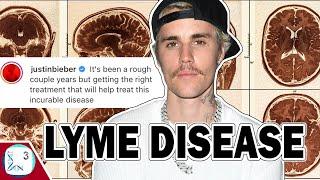 Lyme Disease Is On The Rise. And Its Bad.