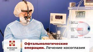 Офтальмологические операции. Лечение косоглазия у взрослых. Лечение косоглазия у детей