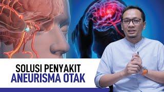 Aneurisma Otak Penyebab Gejala dan Penanganannya  Kata Dokter