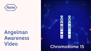 Angelman Syndrome