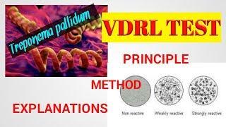 VDRL TestVDRL test procedureTreponema pallidum Microbilogysyphilis testSTDSTAR LABORATORY