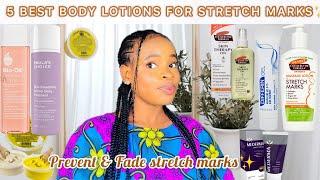 *BEST BODY LOTION FOR STRETCH MARKS* Stretch Mark Removal +Body Lotion For Stretch Marks #oils #glow