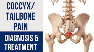 CoccyxTailbone Pain Diagnosis & Treatment