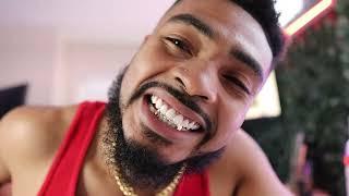 Custom Gold Grillz Review  Not What You Expect