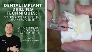 Dental Implant Drilling Techniques Speeds Angulations and Implant Placement