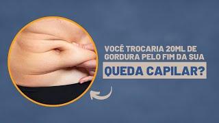 Células-tronco no tratamento da queda capilar  Dra. Débora Cadore  Dermatologista Florianópolis