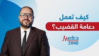 شاهد كيف تعمل دعامة القضيب  الدعامة الهيدروليكية  دكتور صلاح الهمشري  Medicazone