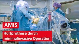Hüftprothese durch minimalinvasive AMIS Methode - Live Operation