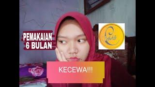 REVIEW SKINCARE BEBWHITE C PEMAKAIAN 6 BULAN  KO MAKIN BANYAK JERAWAT NYA?