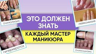 ЭТО ДОЛЖЕН ЗНАТЬ КАЖДЫЙ МАСТЕР МАНИКЮРА Болезни ногтевого аппарата онихолизис онихорексис и т.д.