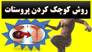 Prostate روش های کوچک کردن پروستات و درمان درد التهاب و شب ادراری