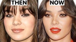 Hailee Steinfeld NEW FACE  Plastic Surgery Analysis