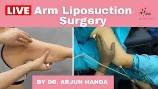 Arm Liposuction - LIVE Surgery Dr. Arjun HandaArm Lift Surgery at Handa Aesthetics Delhi NCR