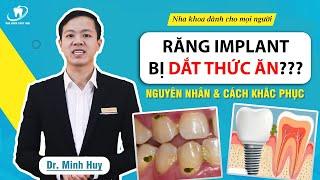 Răng Implant bị dắt thức ăn nguyên nhân và cách khắc phục