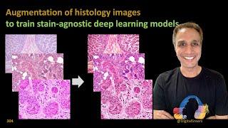 304 - Augmentation of histology images​ to train stain-agnostic deep learning models
