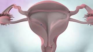 Cancers of the female reproductive system  Cancer Research UK
