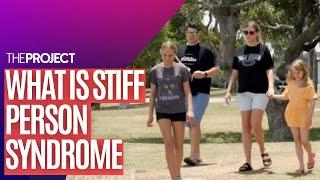 Stiff Person Syndrome The Progressive Condition That Causes Muscles To Stiffen And Is Incurable