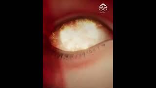 Power of ASURA Demon Eye   #anime  #soulland  #shorts  Tang san asura demon eye used again 