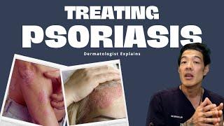 What is Psoriasis? and how to treat it  Dr Davin Lim