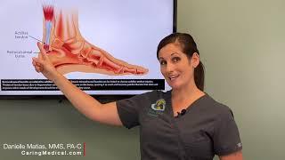 Treating Heel Bursitis and Achilles Tendinopathy with PRP Prolotherapy