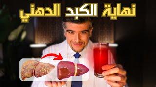 الكبد الدهني؟ امنع تليف الكبد بالطبيعة سر لتنظيف الكبد ️