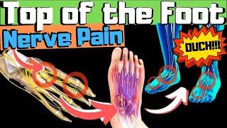 Sharp Burning Tingling Top of Foot Pain? FIX Your Nerve Pain