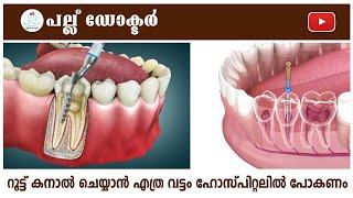 റൂട്ട് കനാൽ ചെയ്യാൻ എത്ര വട്ടം ഹോസ്പിറ്റലിൽ പോകണം?  How Many Visits Are Needed for a Root Canal ?