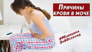 5 причин крови в моче  Почему появляются эритроциты в моче  Норма эритроцитов в моче