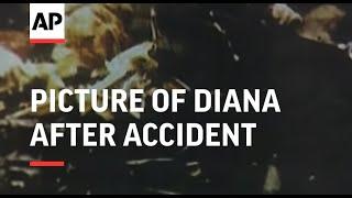 France - Picture of Diana after accident