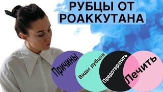 Рубцы после акне роаккутана акнекутана. Келоидные рубцы.