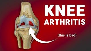 4 Easy Ways To Treat Knee Arthritis Without Drugs ft. the Kineon Move+ Pro